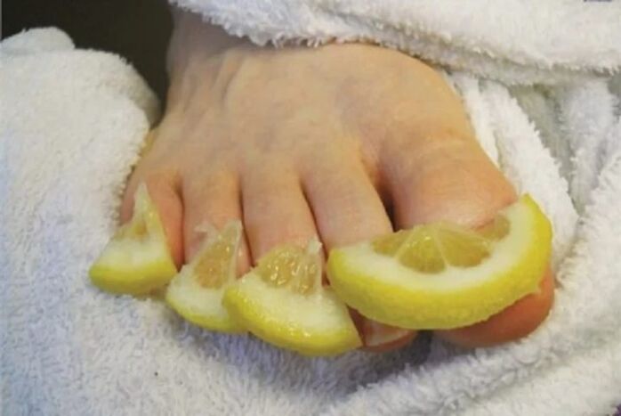 Impacchi di gocce di limone - un rimedio popolare contro i funghi delle unghie dei piedi
